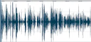 Mesures-pressions-acoustiques-oreille