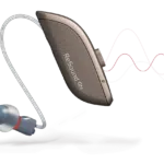 ILLUSTRATION DE LA PROTHESE AUDITIVE RESOUND OMNIA RU 961: équivalent au Ampli Energy R5 Amplifon