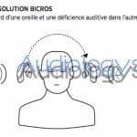 Appareil auditif systeme cros bi cros Phonak sans fil wifi